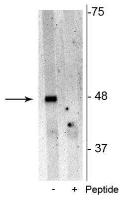 Western Blot: p62/SQSTM1 [p Ser28] Antibody [NBP2-60272]